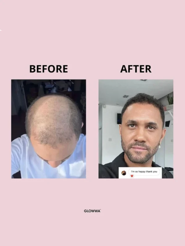 Before and after hair growth transformation results