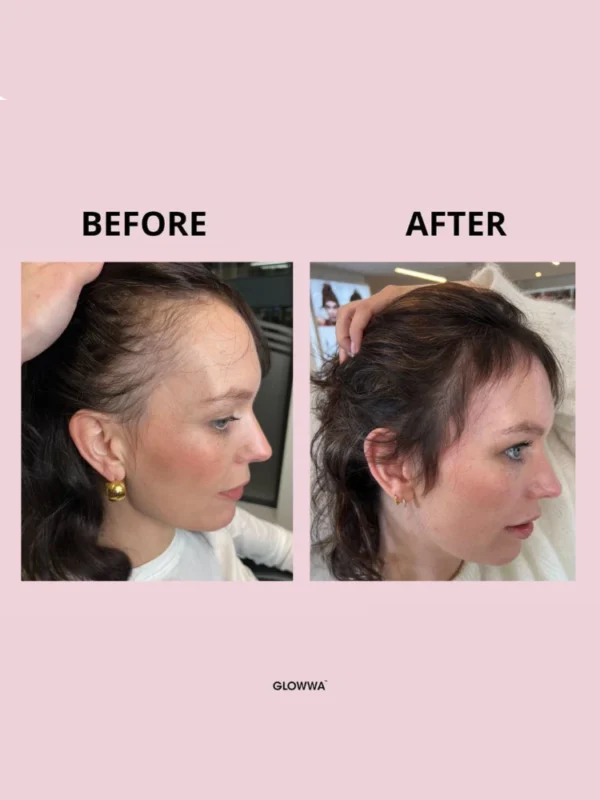 Before and after hair growth comparison